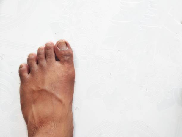 istock People left Foot isolated on white background 1409700073