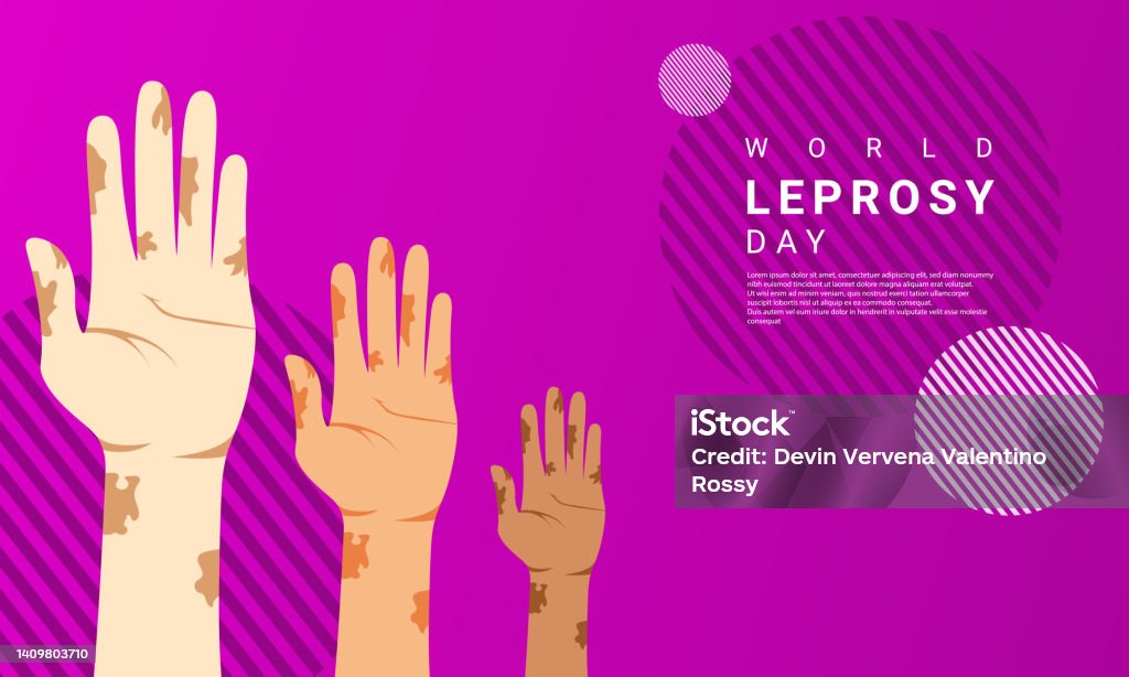 World Leprosy day background is purple in color with a modern design style Leprosy stock vector