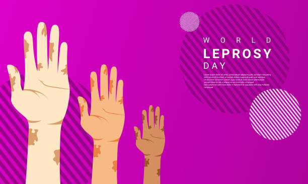 World Leprosy day background is purple in color with a modern design style World Leprosy day background is purple in color with a modern design style leprosy stock illustrations