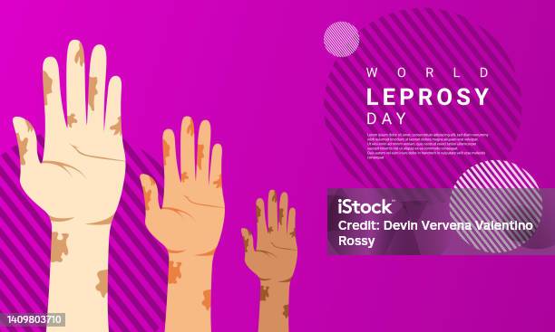 World Leprosy Day Background Is Purple In Color With A Modern Design Style Stock Illustration - Download Image Now
