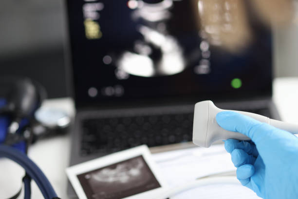 istock Doctor holds ultrasonic probe in hand preparing device for examination 1409873416