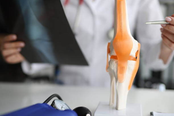 의사는 무릎 관절과 엑스레이의 해부학을 보여줍니다 - cartilage patella human knee medical exam 뉴스 사진 이미지