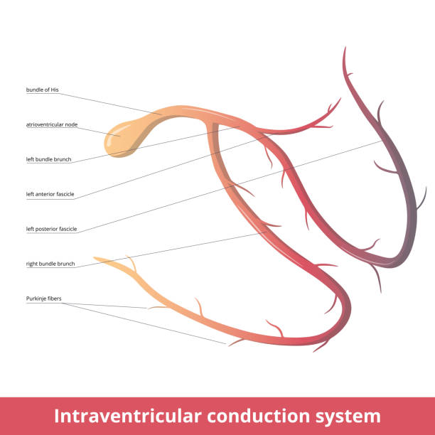 Intraventricular conduction system Intraventricular (electrical) conduction system of the heart transmits signals generated by the sinoatrial node to cause contraction of muscle:  atrioventricular node, Purkinje fibers, bundle of His cardiac conduction system stock illustrations