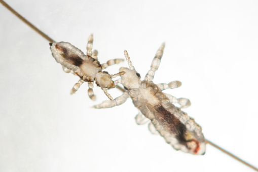 Real photo of head lice. Adult head louse with nymfa head louse on human hair above white background. Pediculus capitis. Human infectious disease.