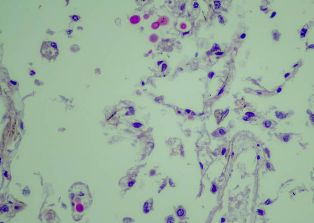 kryptokokowe zapalenie płuc - fungus pathogen scientific micrograph high scale magnification zdjęcia i obrazy z banku zdjęć