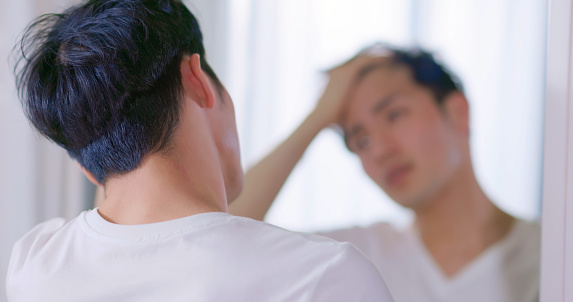 portrait of asian man touching forehead worried for hair loss and looking at mirror his receding hairline