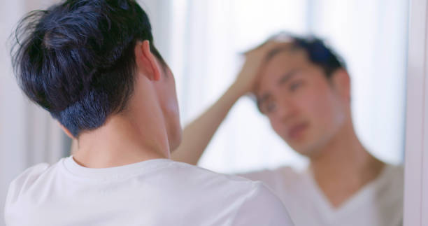 man worried about hair loss portrait of asian man touching forehead worried for hair loss and looking at mirror his receding hairline falling behind stock pictures, royalty-free photos & images