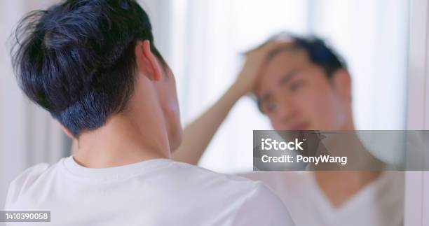 Man Worried About Hair Loss Stock Photo - Download Image Now - Men, Hair Loss, Only Men