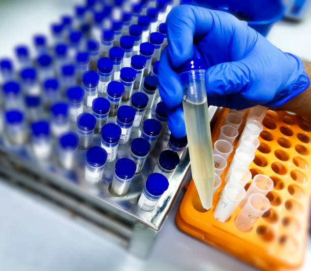 istock Technician hold urine sample for medical analysis with laboratory background. 1410499279