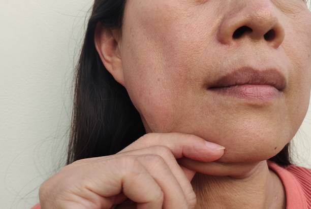 istock The flabbiness adipose sagging skin beside the cheeks 1410592308