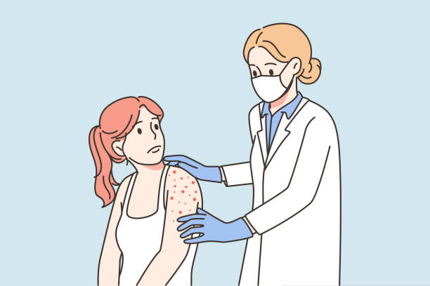 Doctor examine patient with red rash Doctor checking woman with red pimples on body. Nurse examine female patient with rash on shoulder. Monkeypox or smallpox virus. Vector illustration. mpox stock illustrations