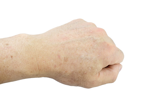 Age spots on hands of man. Liver spots, Brown, black or sun spots, Senile lentigo, Solar lentigines. Premature aging skin, Dermatology, Symptomatology Elderly Person. Isolated on white background.