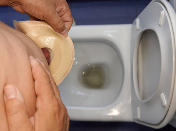 istock A man putting a colostomy bag on his 
bathroom 1410676872