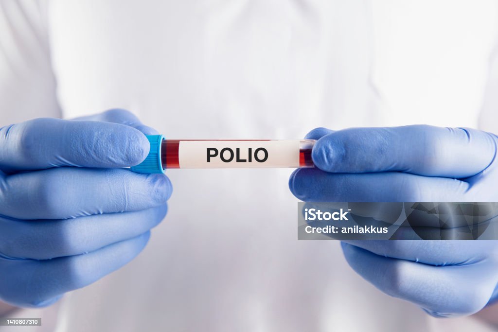 Polio Vaccine Polio vaccine vial Polio Stock Photo