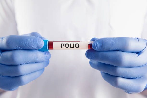 Polio Vaccine Polio vaccine vial polio vaccine stock pictures, royalty-free photos & images
