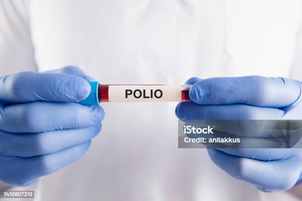 Polio Vaccine Stock Photo - Download Image Now - Polio, Polio Vaccine, Test Tube