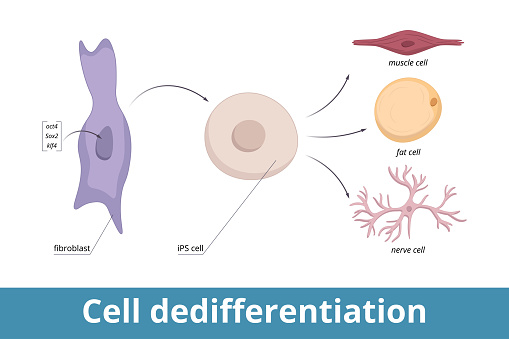 Genes encoding three transcription regulators are artificially introduced into the fibroblast nucleus, the cell divides in culture (iPS cell), cell is induced to de-differentiate.