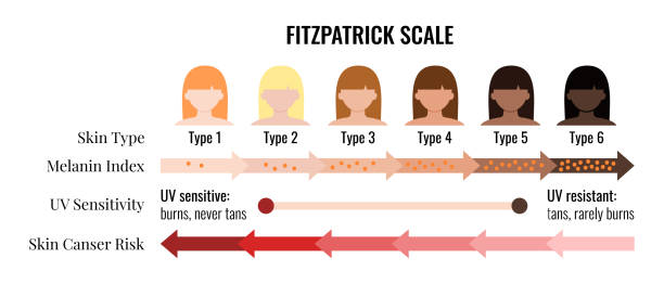 Fitzpatrick skin tone scale phototype melanin index with female avatar. Fitzpatrick skin tone scale phototype melanin index with female avatar. Chart element with type I II III IV V IV human skin hair color melanin content in the cell cancer risk flat vector illustration skin tone chart stock illustrations