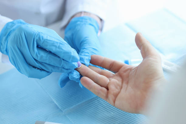 Nurse lab technician in gloves, using painless scarifier to prick finger of patient stock photo