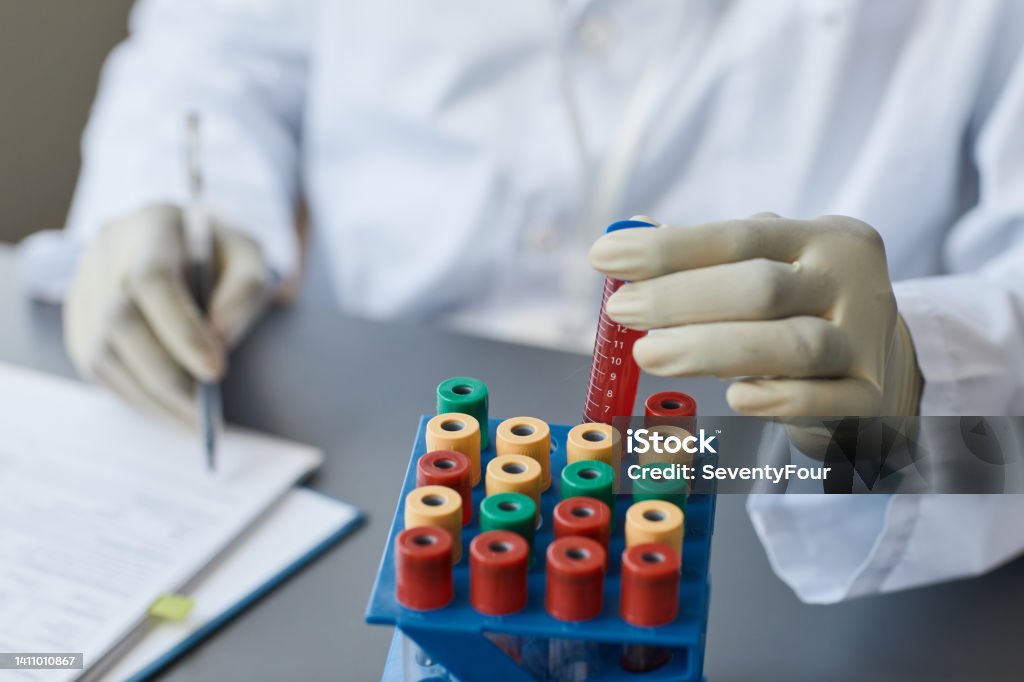 Lab Technician Working With Samples Stock Photo - Download Image Now ...
