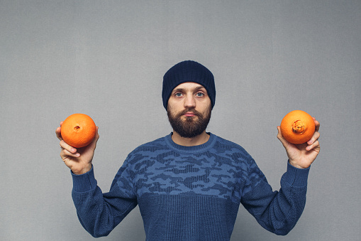 El hombre barbudo muestra naranjas normales y feas, concepto de hemorroides o enfermedades proctológicas. photo