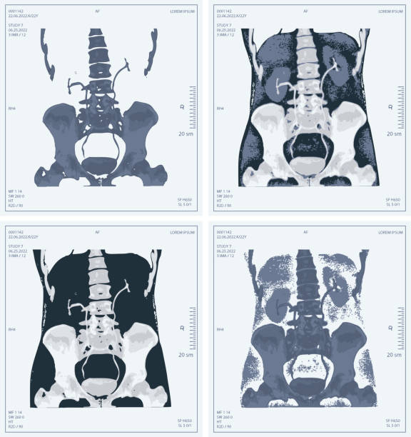 ilustraciones, imágenes clip art, dibujos animados e iconos de stock de radiografía vectorial establecida del abdomen humano con hueso pélvico y columna vertebral - cat scan abdomen medical scan x ray