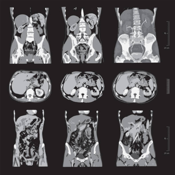 ilustraciones, imágenes clip art, dibujos animados e iconos de stock de radiografía vectorial establecida del abdomen humano con hueso pélvico y columna vertebral - cat scan abdomen medical scan x ray