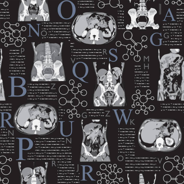 ilustraciones, imágenes clip art, dibujos animados e iconos de stock de radiografía del abdomen humano con hueso pélvico y columna vertebral - cat scan abdomen medical scan x ray
