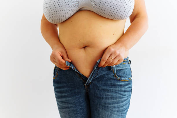 istock overweight woman wears small size clothes. 1411267288