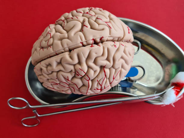 istock Scalpel clamps and brain anatomy model. Performing brain surgery 1411336868