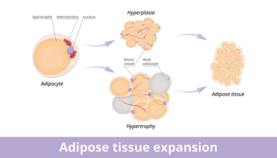 Mechanisms of adipose tissue expansion: hypertrophic and hyperplasic adipose. Hypertrophic and hyperplasic fat cells in fat tissue.