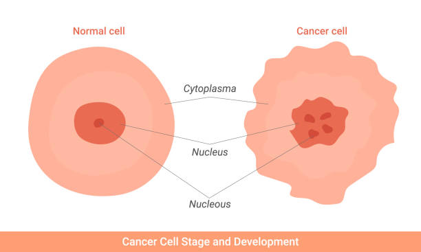 Cancer cell stage and development illustration Cancer cell stage and development illustration epithelium stock illustrations