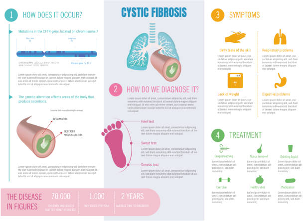 Infographic about cystic fibrosis disease, what is its origin, symptoms, diagnosis, treatments. Infographic about cystic fibrosis disease, what is its origin, symptoms, diagnosis, treatments. pulmonary artery stock illustrations