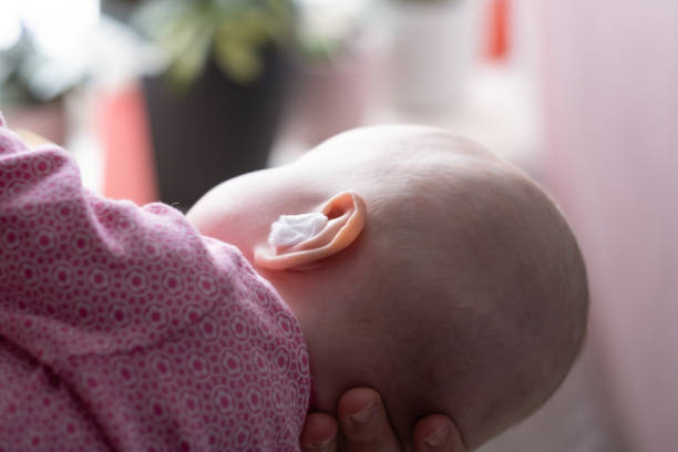 Caucasian baby with medication in ear. Infection treatment stock photo