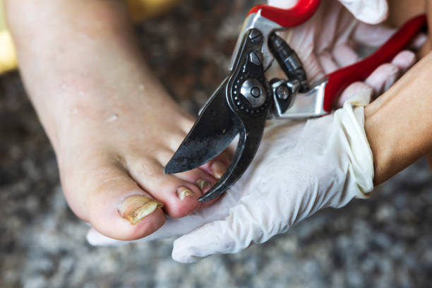 정원 가위가있는 정말로 무시 된 손톱의 페디큐어 클로즈 업 개념 - pedicure podiatry beauty nail clipper 뉴스 사진 이미지