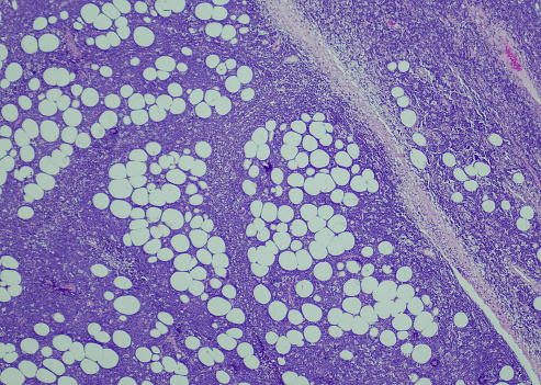 Liver Fluke Section under light microscope with white background