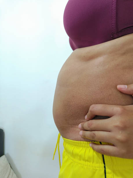 istock Side view. Fat Asian woman standing showing her belly 1411793256