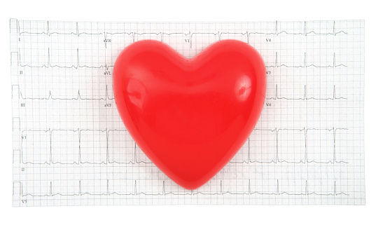 A stethoscope on a printout of a cardiogram Chart (ECG)