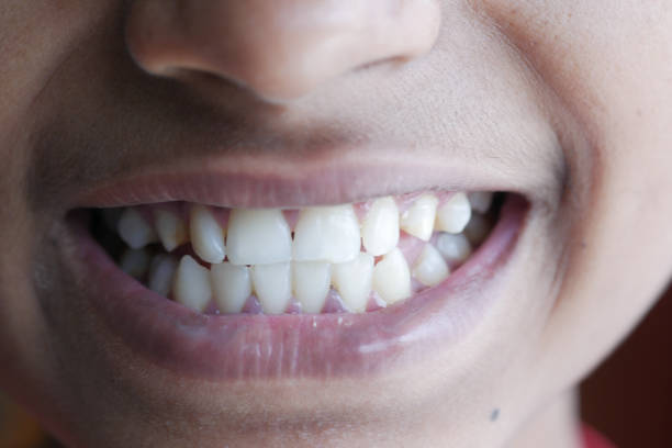 istock teenage boy smiling with healthy white teeth. 1411925032