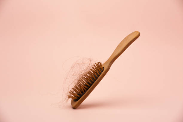 istock hair loss 1412000838
