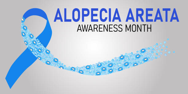 ilustrações, clipart, desenhos animados e ícones de banner do mês de conscientização da alopecia areata - alopecia antes depois