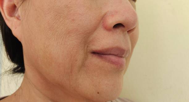 The wrinkles and flabby skin, blemishes and dark spots on the face of the woman. Portrait showing the flabbiness adipose sagging skin beside the mouth, dullness and blemishes, problem wrinkled and dark spots on the face of the woman, concept health care. animal jaw bone stock pictures, royalty-free photos & images