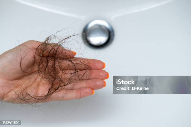 Hair Loss Problem Stock Photo - Download Image Now - Falling, Hair Loss, Alopecia