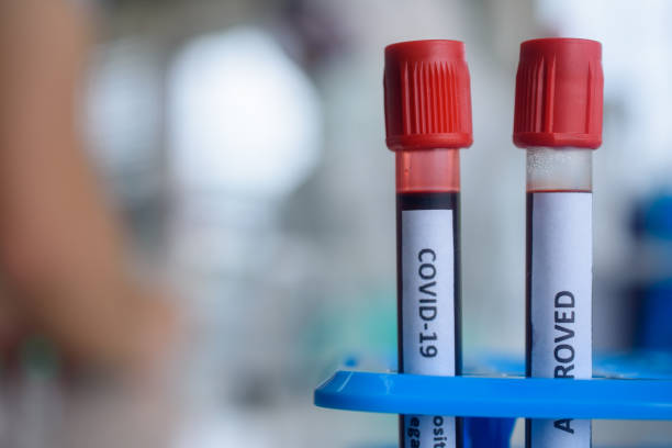 istock Doctor, scientist, researcher Currently studying and analyzing blood samples of corona virus patients 2019 for use in research and experiment in medicine for treatment of patients in hospitals. 1412458860