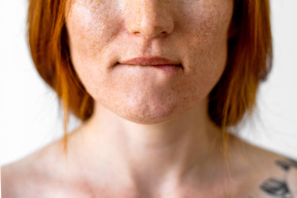Woman biting her lip