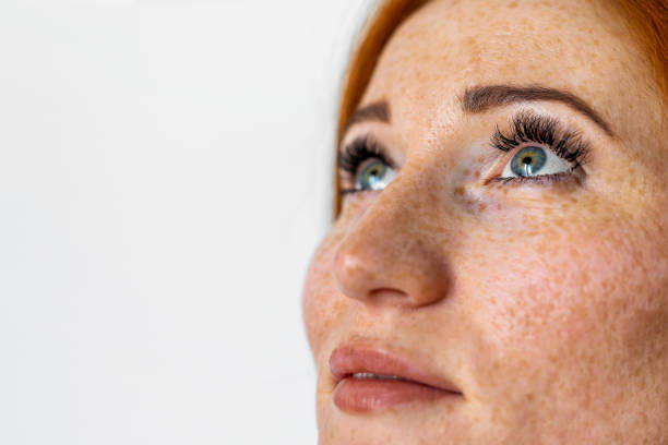 istock Freckles young woman 1412610550