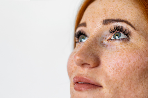 Freckles young woman