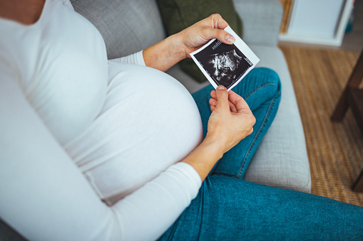 Pregnant woman holding ultrasound image. Concept of pregnancy, health care, gynecology, medicine. Young mother waiting of the baby. Close-up, copy space, indoors.