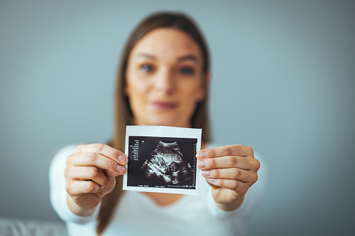 Happy young pregnant woman holding an ultrasound scan image. Smiling beautiful mother with ultrasound of her unborn baby. Pregnancy concept, maternity prenatal care.