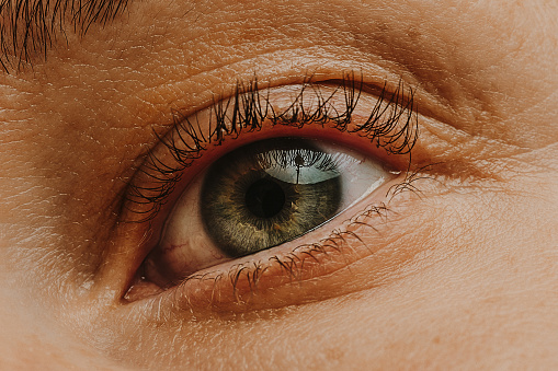 Eye of an elderly man with cataracts, clouding of the lens, macro